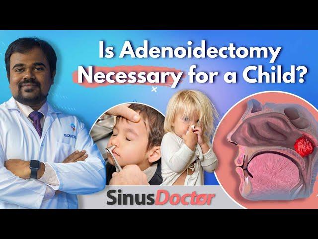 What are Adenoids | Causes | Symptoms [ Is Adenoidectomy Necessary for a Child? ] #SinusDoctor