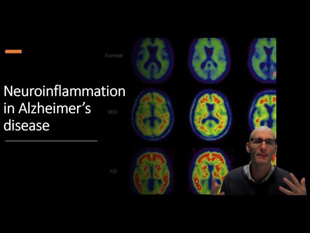 Neuroinflammation in Alzheimer's Disease: The Role of Microglia