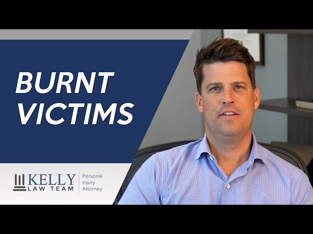 Personal Injury Attorney Shares Tips on Burn Injuries | Kelly Law Team