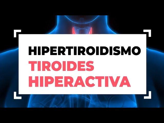 Hipertiroidismo