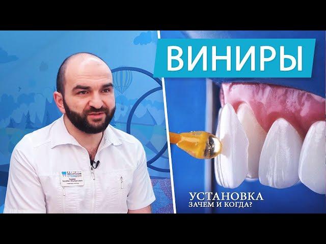 Виниры - плюсы и минусы. Зачем и когда устанавливать | часть 1