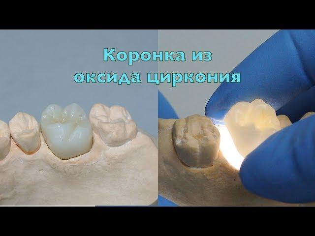 Безметалловая коронка, вкладка, виниры, мосты из оксида циркония | стоматология Самара