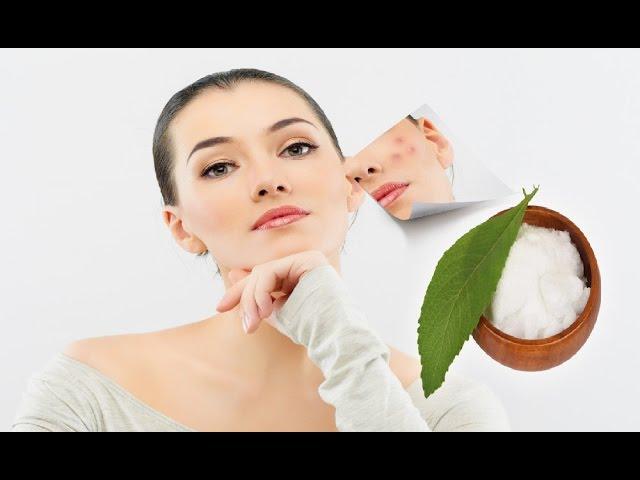 beauty skin care  5 Amazing Benefits Of Camphor For Skin care routine