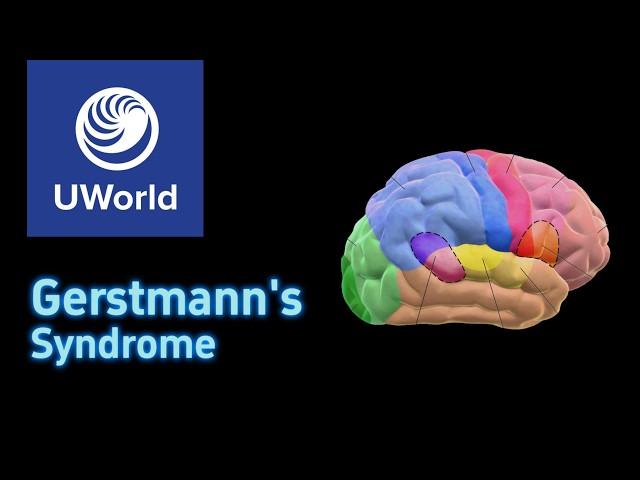 Gerstmann's Syndrome - USMLE UWorld Question, Nervous System, USMLE Step 1 Review