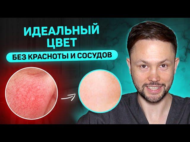 Как избавиться от покраснений и сосудов на лице? Лучшие советы и процедуры от дерматолога