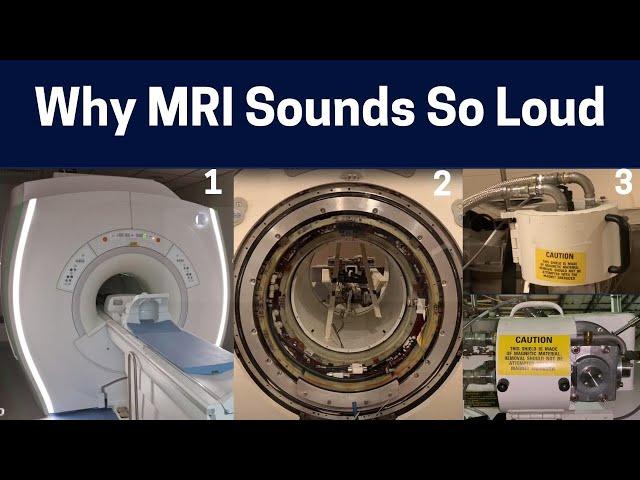 What Makes The Different MRI Scan Sounds? Knocking to Rhythmic Chirping MRI Sounds Explained