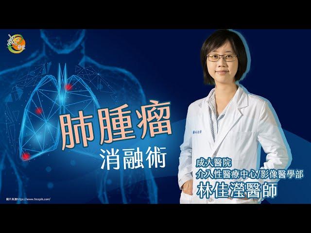 【成大醫院】成大e學堂 《肺腫瘤消融術》 影像醫學部林佳瀅醫師