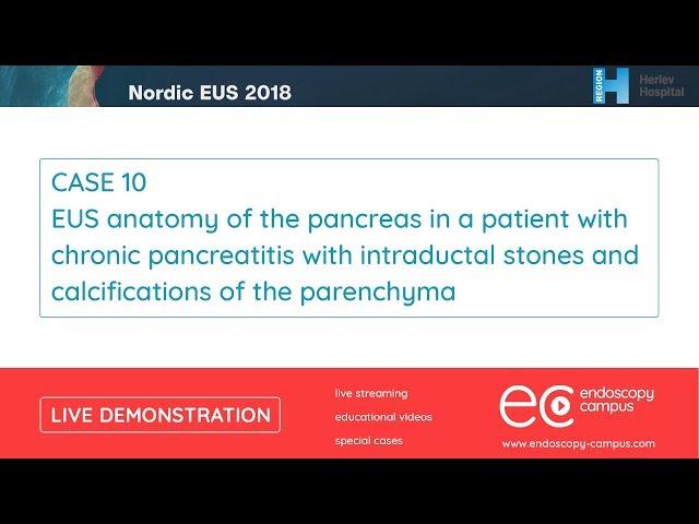 Livedemo | Nordic EUS 2018 | EUS anatomy of the pancreas in a patient with chronic pancreatitis