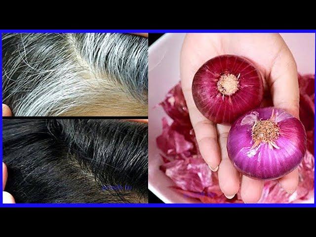 Onion in 5 minutes black hair naturally at home permanently / white hair to black hair naturally