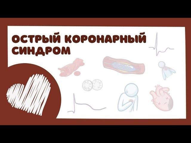 ОКС Острый Коронарный Синдром - тактика ведения, лечение (лекция) инфаркт