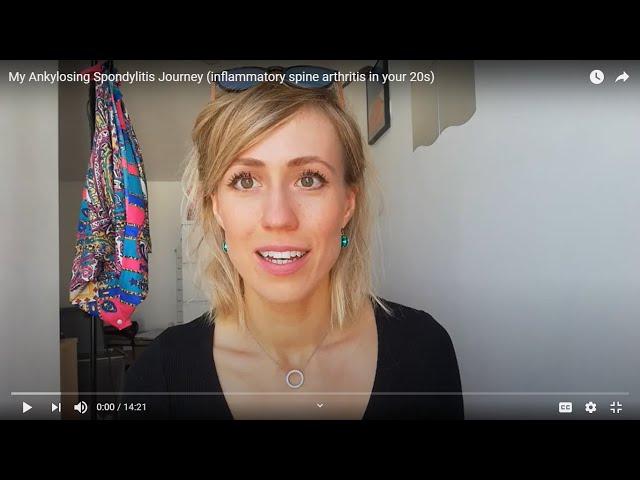 My Ankylosing Spondylitis Story | Inflammatory Arthritis in Your 20s | Dash