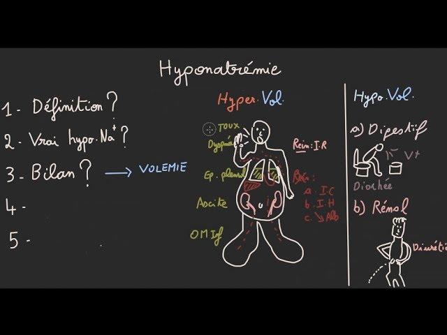 Hyponatrémie en 5 étapes - Docteur Synapse