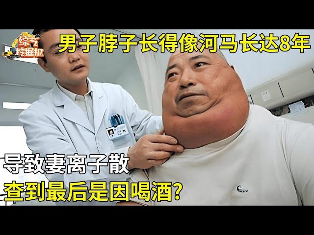 男子脖子长得像河马长达8年,导致妻离子散,查到最后是因喝酒?【真相纪实】