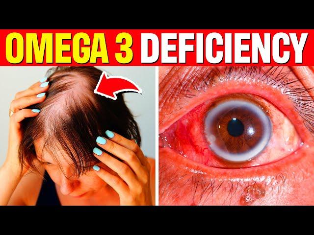 Your Body Needs OMEGA-3 Right Away If You Have These 8 Warning Signs (Omega 3 Deficiency)