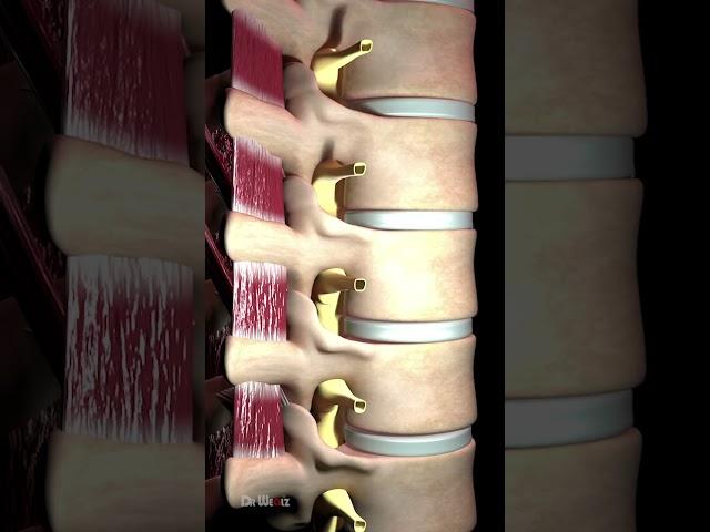 Bulging Disc Explained (Animation)