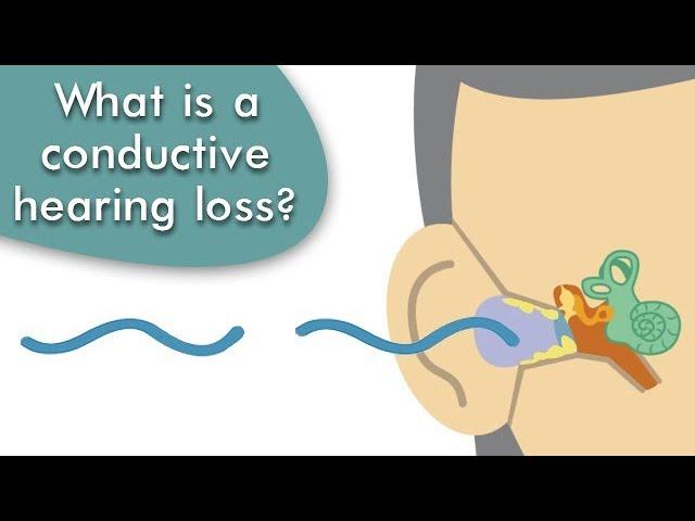 Conductive Hearing Loss Explained