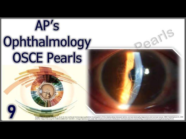 AP's Ophthalmology OSCE Pearls 9