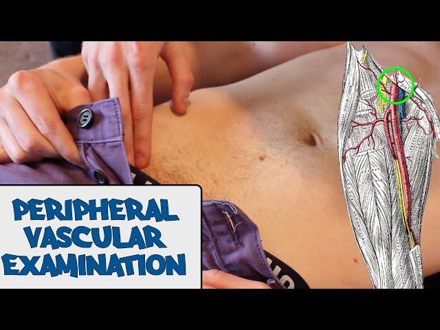 Peripheral Vascular Examination - OSCE Guide (old version) | UKMLA | CPSA | PLAB 2