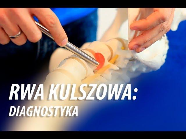 Rwa Kulszowa: Diagnostyka