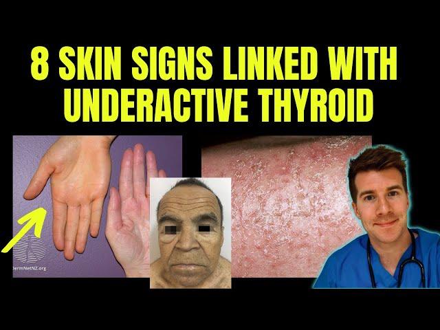 Doctor explains 8 SKIN SIGNS linked with HYPOTHYROIDISM (aka underactive thyroid)