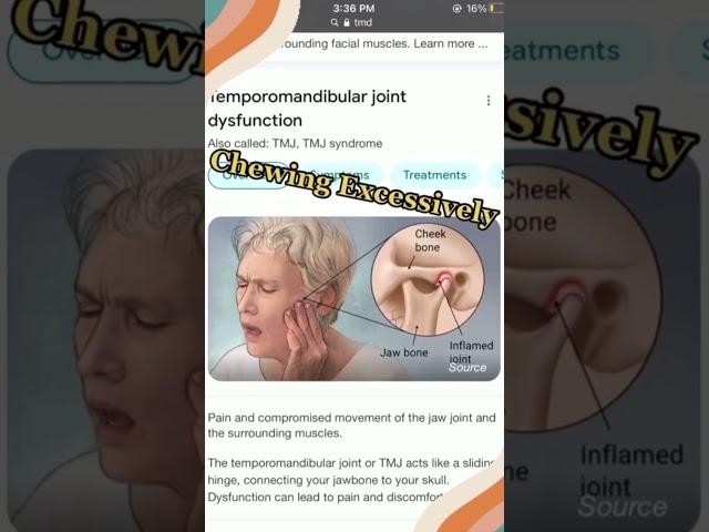 “CHEWING GUM” for jawline??‍️#exercise #science #tips