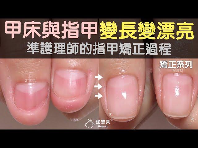 Prospective therapist's nail correction process-nail beds and nails become longer and more beautiful