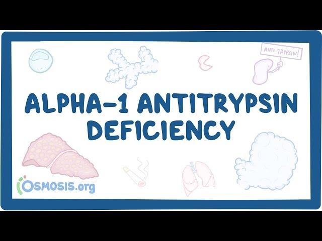 Alpha-1 Antitrypsin Deficiency - causes, symptoms, diagnosis, treatment, pathology