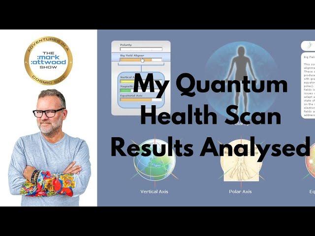 My Quantum Health Scan Results Analysed - 9th July 2024