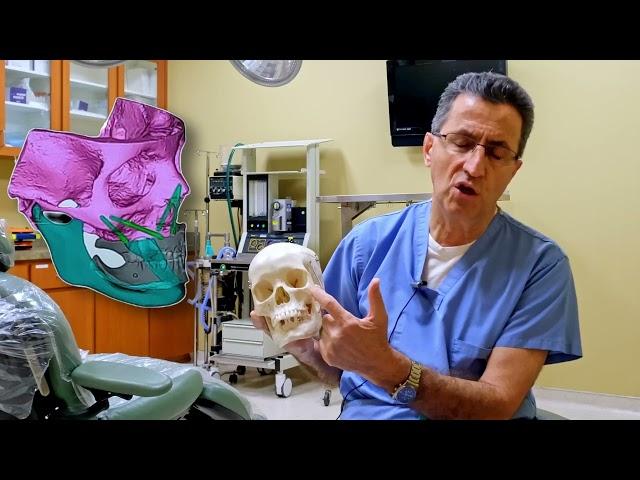 Meet Dr. Hashemian: Zygomatic Implant Overview and Placement Demo