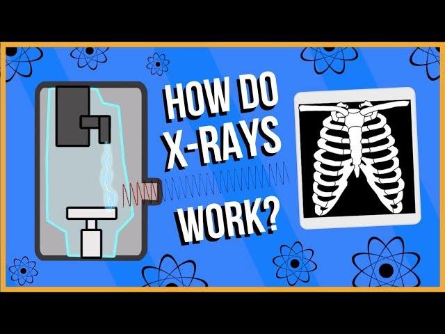 How do X-Rays Work?