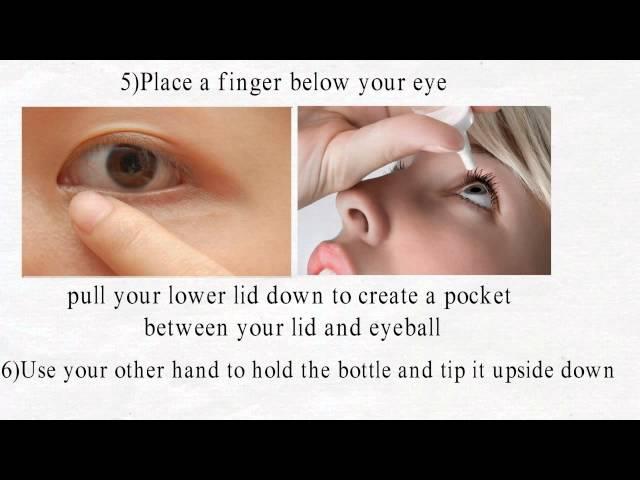 How to put in eye drops