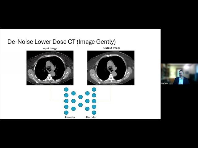 AI4C Lecture Series: Image Intelligently - Applications and Challenges in Pediatric Imaging