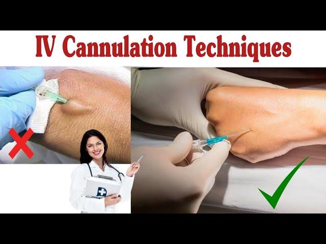 #How To Insert IV Cannula / IV Cannulation Techniques