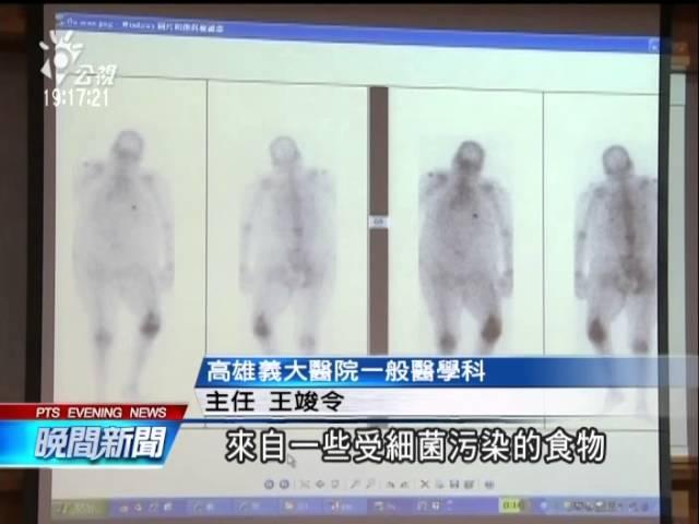 20140514公視晚間新聞－大腸桿菌高抗藥性 入侵人體關節奪命