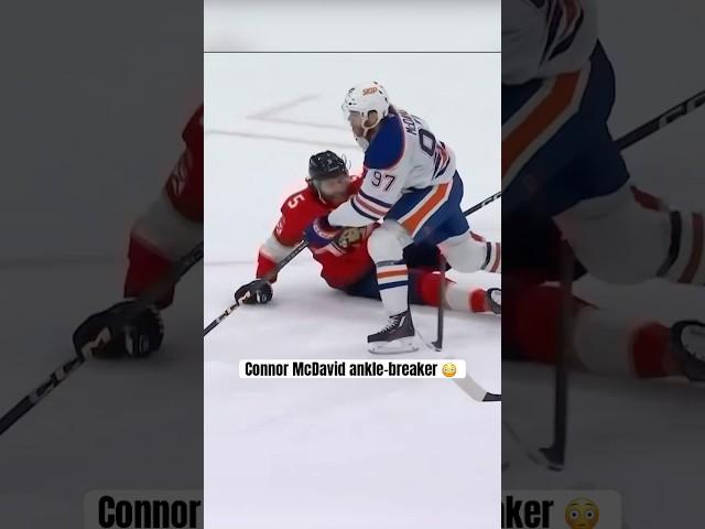 McDavid broke his ankles but got shut down 