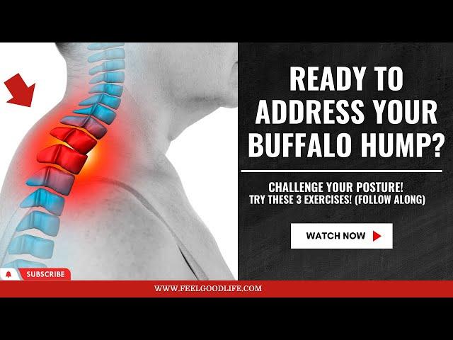 3 Best Exercises for Buffalo Hump Follow Along Routine