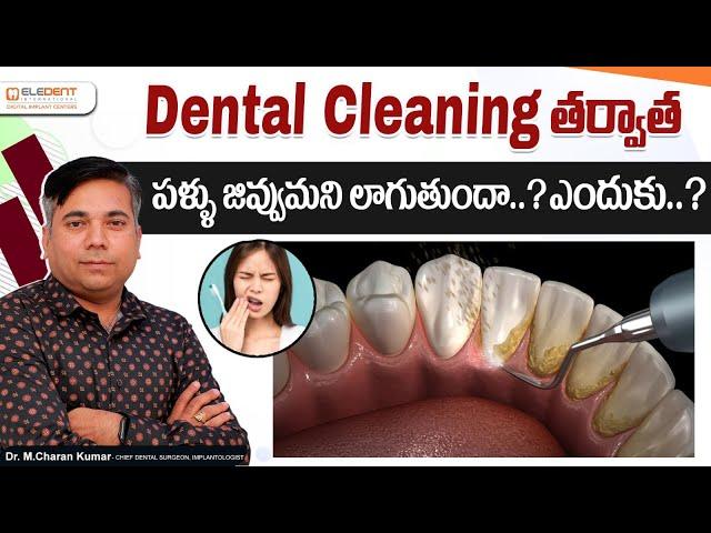 Tooth Sensitivity after Basic Dental Cleaning || Dr M Charan Kumar || Eledent Dental Hospitals