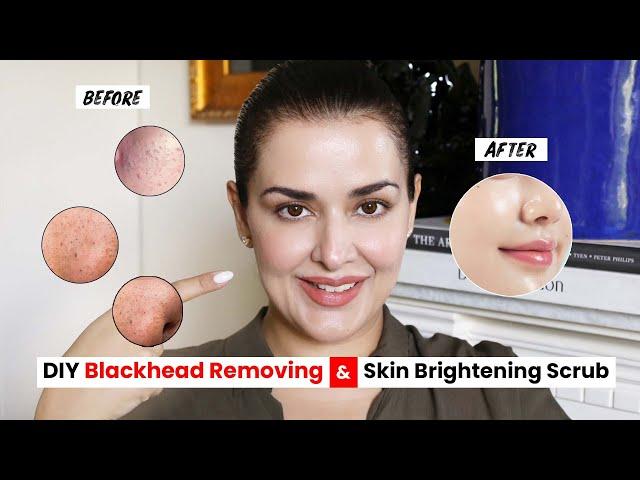 ULTIMATE DIY SCRUB TO GET RID OF BLACKHEADS I PORE CLEARING I SKIN BRIGHTENING