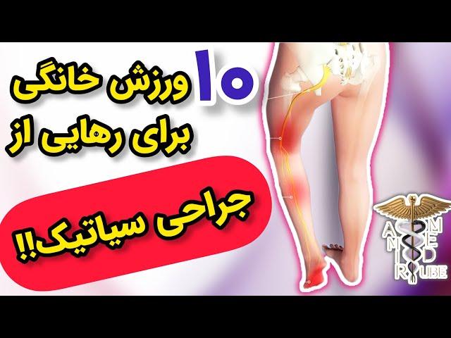 درمان خانگی درد عصب سیاتیک با ۱۰ تمرین ورزشی