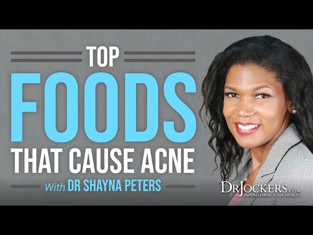 The Foods and Stressors That Trigger Acne and Skin Problems with Dr. Shayna Peter