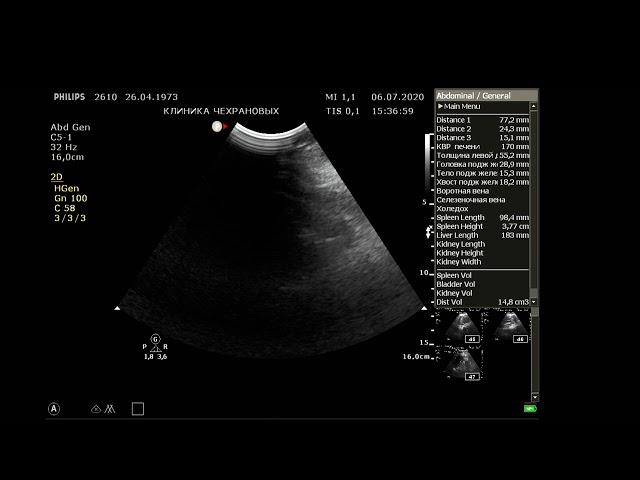УЗИ органов брюшной полости и почек.