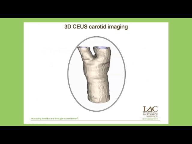 Contrast Enhanced Ultrasound