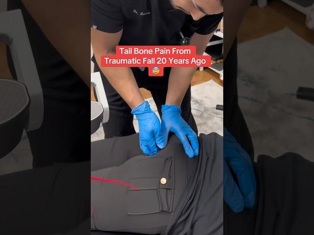 Tailbone *COCCYX* Pain From Fall 20 Years Ago
