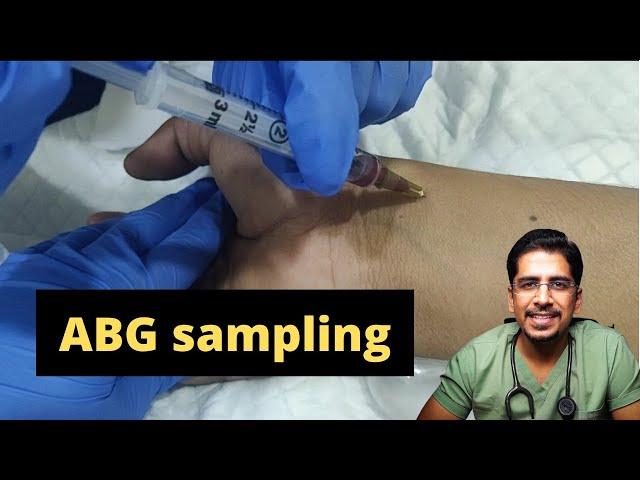 ABG sampling- How & when to do it !!