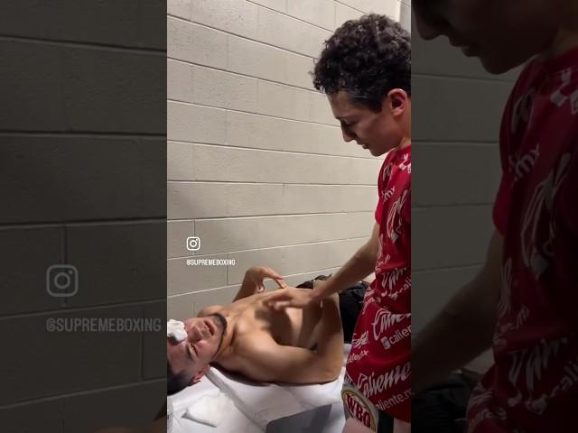EXPLAINED! An Emotional Rafael Espinoza Visits an Injured Edward Vazquez AFTER their Battle