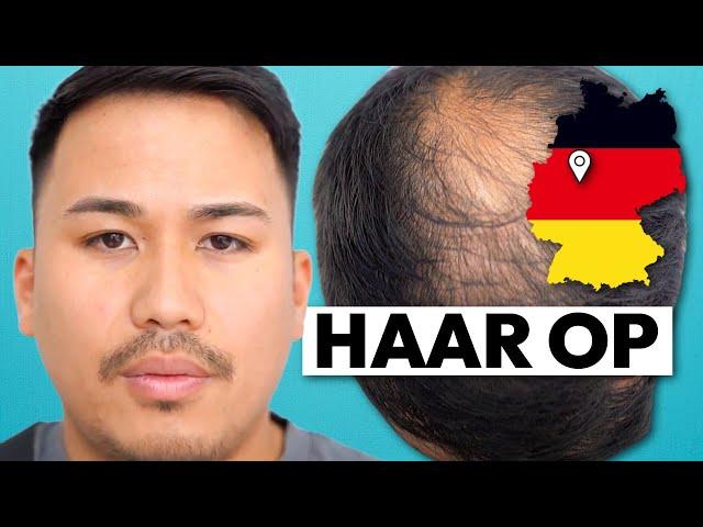 Beratung zur Haartransplantation in Deutschland | Minh's Erfahrung