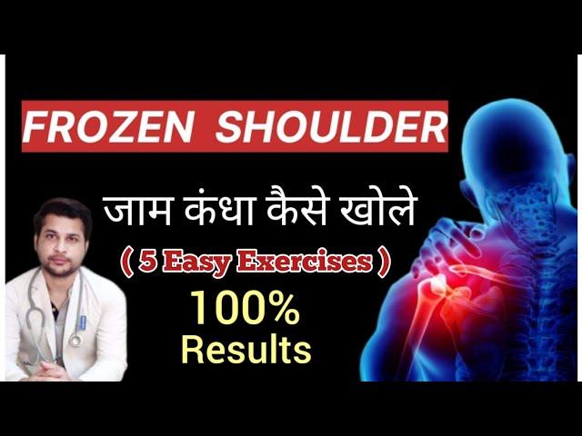 5 Effective Exercises for Frozen Shoulder (Do it once)100% result.