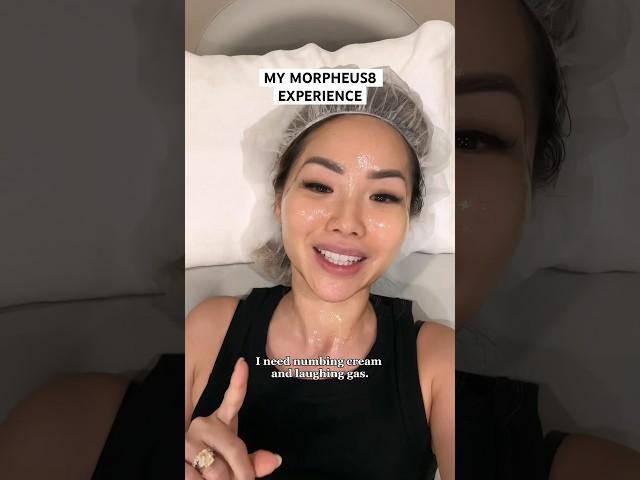 Morpheus8 beauty treatment experience #morpheus #microneedling #beautytips #skincareroutine