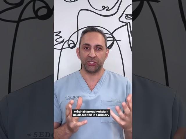 Q&A: Rhinoplasty VS Revision Rhinoplasty