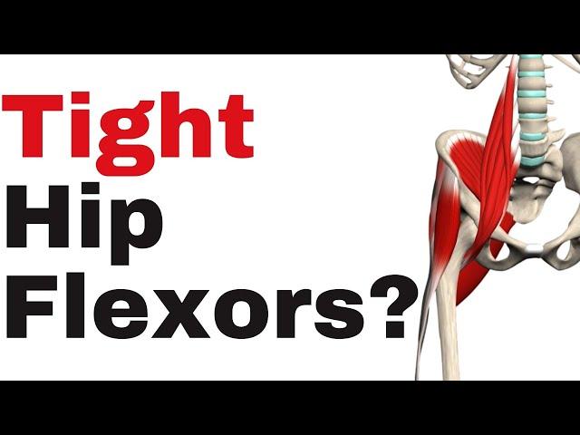 The 2 Step Approach for Tight Hip Flexors